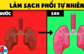 Vào 'mùa' ô nhiễm không khí, áp dụng ngay 7 cách làm sạch phổi tự nhiên không cần dùng thuốc