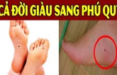 3 nốt ruồi tụ tài, tụ lộc: Ai có 1/3 cũng đủ sung túc, cả đời chẳng thiếu tiền tiêu