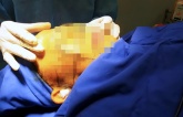 Việt kiều Mỹ 70 tuổi tử vong bất thường khi đi về nước căng da mặt