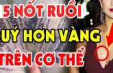 Nốt ruồi thần Tài đánh dấu, số son vận đỏ, ai có 1 cái thì xin chúc mừng