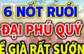 3 nốt ruồi ăn lộc đất đai, sau 40 tuổi đổi đời vượng phát, tuyệt đối đừng tẩy xóa