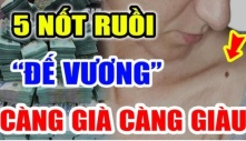 5 nốt ruồi 'Đế Vương' càng già càng giàu: Ai có 1/5 cũng viên mãn cả đời, rất đáng chúc mừng