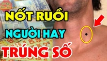 Nốt ruồi thần Tài 'đánh dấu', số son vận đỏ, ai có 1 cái thì xin chúc mừng