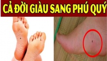 3 nốt ruồi tụ tài, tụ lộc: Ai có 1/3 cũng đủ sung túc, cả đời chẳng thiếu tiền tiêu