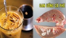 4 giờ vàng uống cà phê giúp cơ thể ‘hưởng lợi’ đủ đường, gan sạch độc, tiêu hóa trơn tru