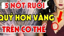 Nốt ruồi thần Tài đánh dấu, số son vận đỏ, ai có 1 cái thì xin chúc mừng