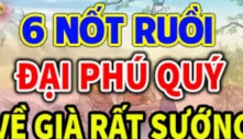 3 nốt ruồi ăn lộc đất đai, sau 40 tuổi đổi đời vượng phát, tuyệt đối đừng tẩy xóa