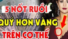 Nốt ruồi thần Tài 'đánh dấu', số son vận đỏ, ai có 1 cái thì xin chúc mừng