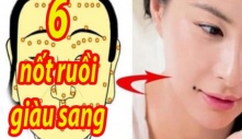 6 nốt ruồi giàu sang, dù nam hay nữ sở hữu 1 cũng đủ phát tài hơn người