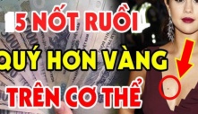 Nốt ruồi thần Tài 'đánh dấu', số son vận đỏ, ai có 1 cái thì xin chúc mừng