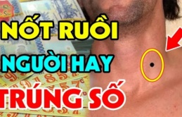 Nốt ruồi thần Tài 'đánh dấu', số son vận đỏ, ai có 1 cái thì xin chúc mừng