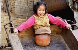 “Cô bé bóng rổ” mất nửa người vẫn lạc quan khiến thế giới cảm phục 15 năm trước: Kinh ngạc với cuộc sống thay đổi hoàn toàn ở hiện tại