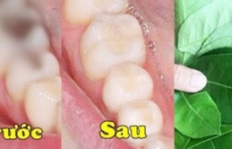 Dùng nắm lá chanh đun đặc: Chữa dứt luôn sâu răng, viêm lợi, hôi miệng lâu năm