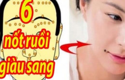 6 nốt ruồi giàu sang, dù nam hay nữ sở hữu 1 cũng đủ phát tài hơn người