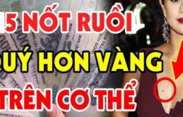 Nốt ruồi thần Tài 'đánh dấu', số son vận đỏ, ai có 1 cái thì xin chúc mừng