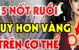 Nốt ruồi ở tai dự báo tương lai, vận mệnh của bạn như thế nào?