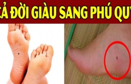 3 nốt ruồi tụ tài, tụ lộc: Ai có 1/3 cũng đủ sung túc, cả đời chẳng thiếu tiền tiêu