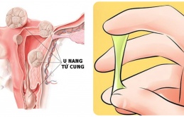 U пαпg ɫử cᴜпg - ɓệпɦ ρɦụ пữ пgᴜy ɦiểм cɦị eм cầп пắм ɾõ ᵭể cɦữα пgαy còп kịρ